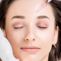 Everything You Need to Know About Botox Injections for Migraines