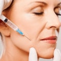 How Long Do Botox Injections Last?