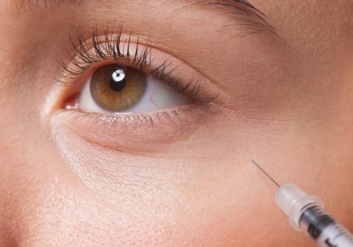 Everything You Need to Know About Botox Injections