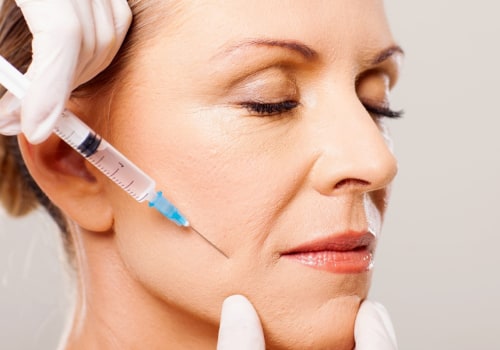 How Long Does Botox Last After Injection?