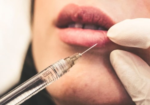 Where to Buy Botox Injections Safely and Easily